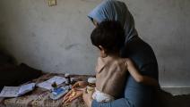 المجاعة في غزة تهدد حياة الأطفال في شمال القطاع، 9 يونيو 2024 (فرانس برس)