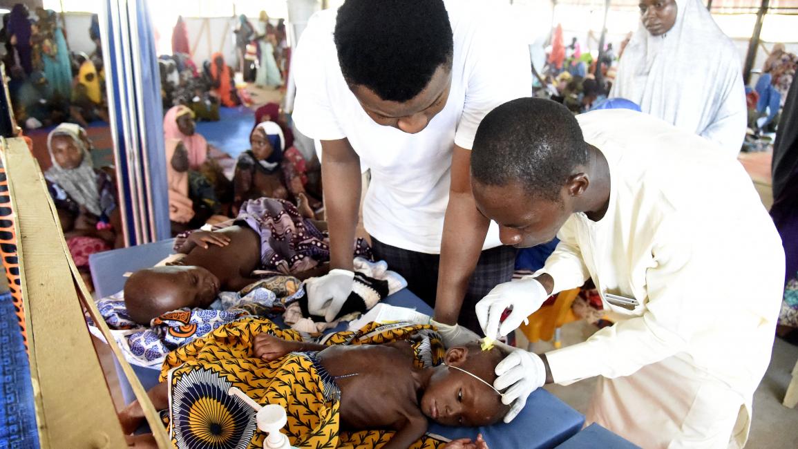 أطفال نيجيريا الغنية يعانون من سوء التغذية (بيوس أوتومي ايكيبي/فرانس برس)