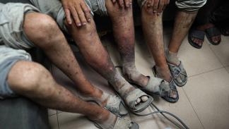 معتقلون فلسطينيون سابقون بمستشفى الأقصى، 1 يوليو 2024 (فرانس برس)