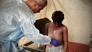 تنتشر الأمراض الجلدية في مخيمات غزة، يونيو 2024 (الأناضول)