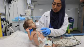 سوء التغذية يهدد حياة اطفال غزة، 9 يوليو 2024 (فرانس برس)