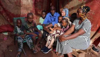 رقية امرأة مصابة بالمهق في مالي في أفريقيا 3 (الأناضول)