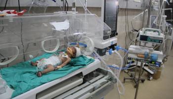 سوء التغذية يهدد حياة أطفال غزة (محمود عيسى/ الأناضول)