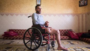وائل النملة بُترت قدمه في القصف الإسرائيلي على غزة في 1 أغسطس 2014(فرانس برس)