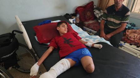 فقد آلاف من أطفال غزة أطرافهم خلال العدوان (هاني الشاعر/الأناضول)